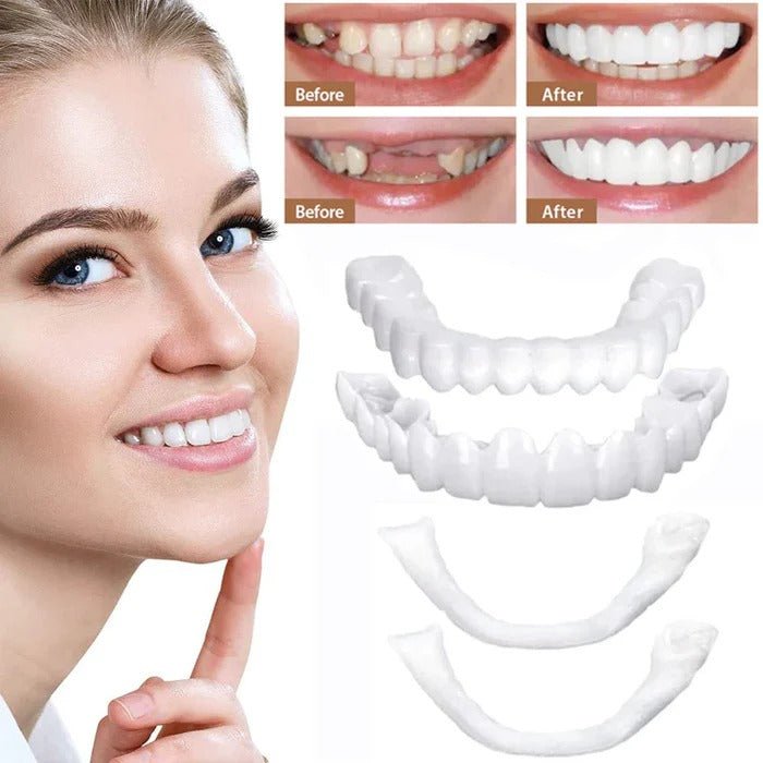 Veneers for Teeth with Natural White Finish - TRENDVYO