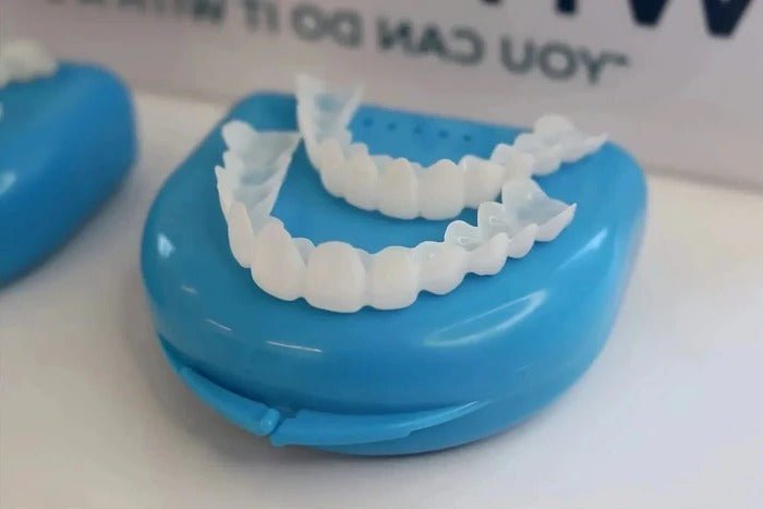 Veneers for Teeth with Natural White Finish - TRENDVYO