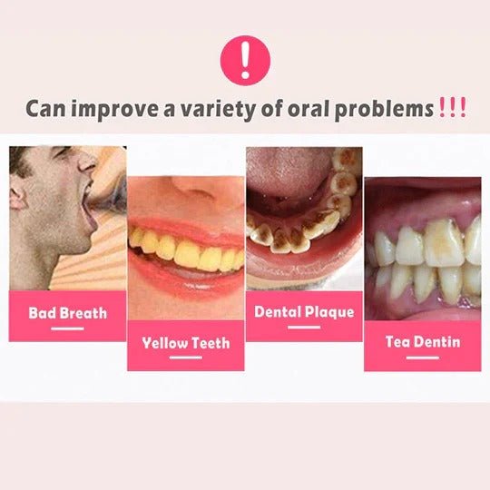 Plaque Remover for Teeth and Gums - TRENDVYO