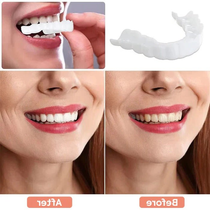 Veneers for Teeth with Natural White Finish - TRENDVYO
