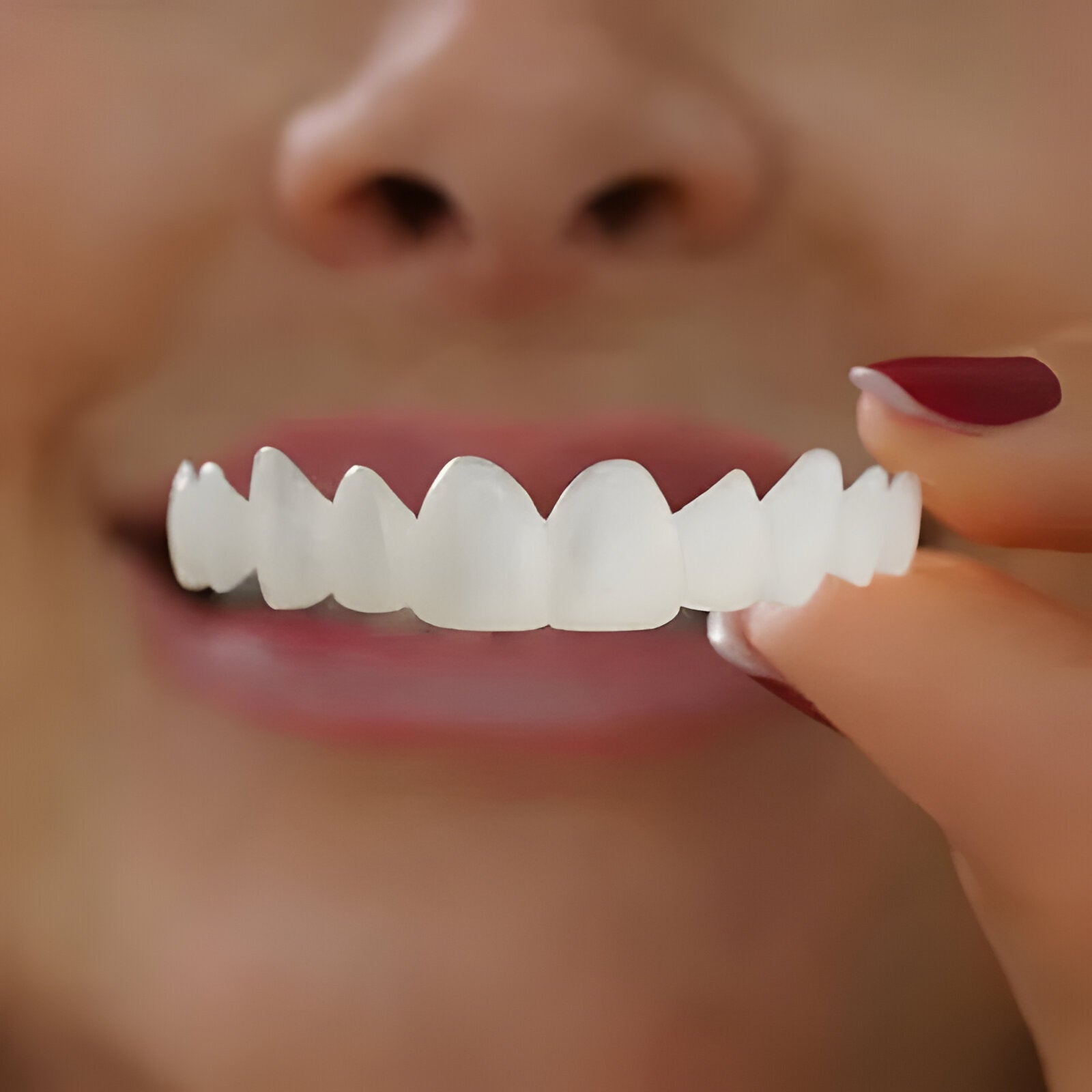 Veneers for Teeth with Natural White Finish - TRENDVYO